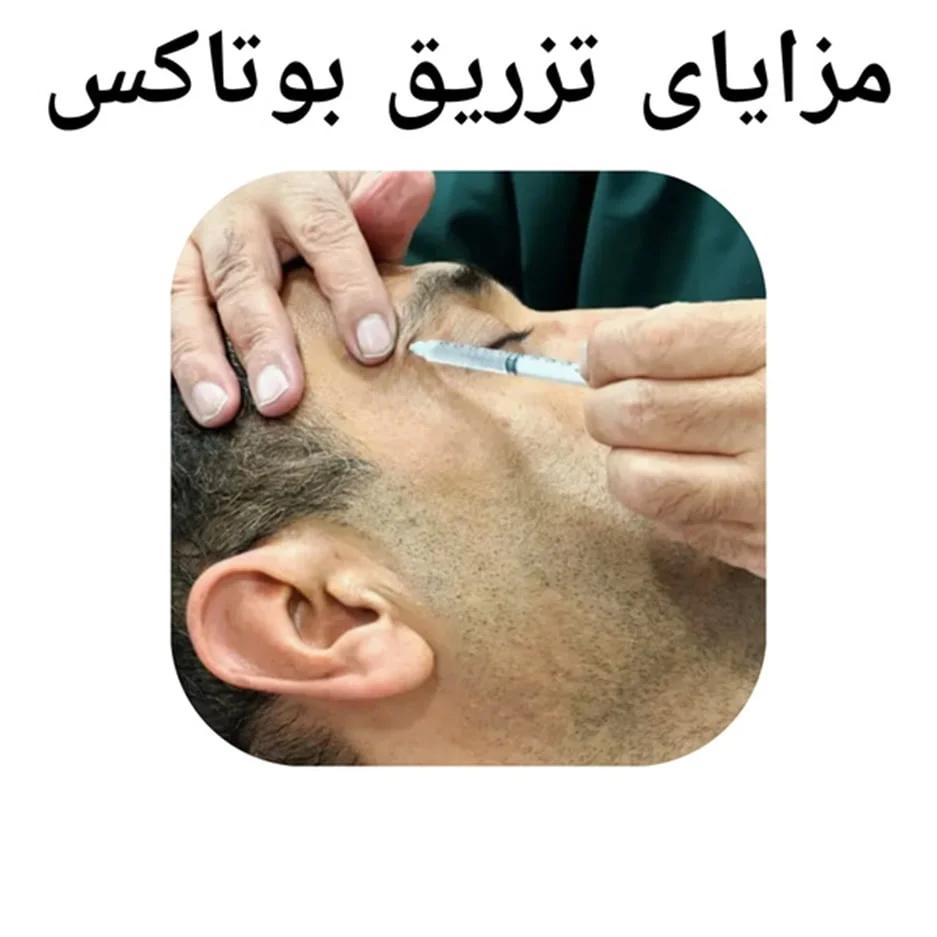 تزریق بوتاکس مزایای تزریق بوتاکس