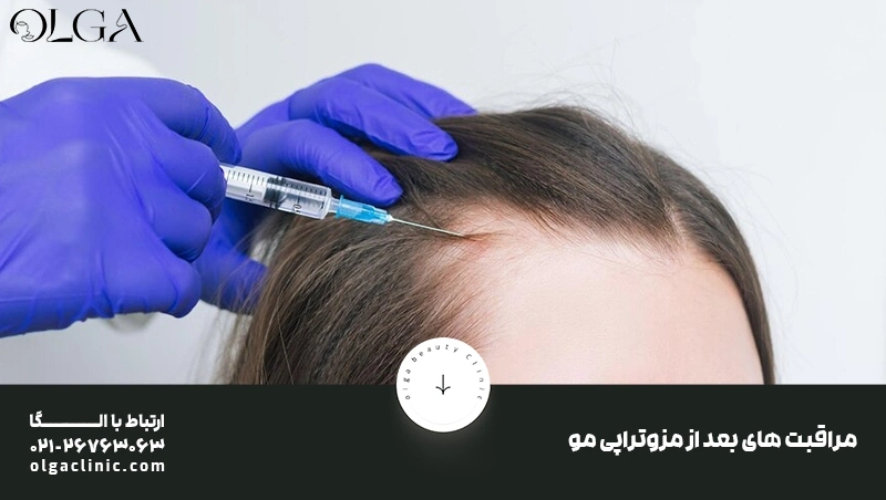 قیمت مزوتراپی مو